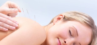arthritis Chinese medicine