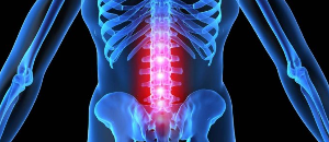 Deformation of the intervertebral disc