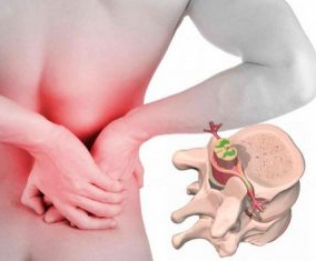 Lumbago at the beginning of the disease osteochondrosis