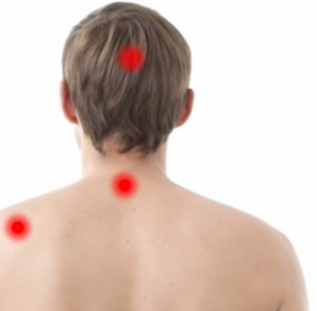 lesions of osteochondrosis
