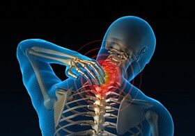 why develops and how cervical osteochondrosis is manifested
